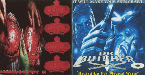 Urinary Tract Infection From Severe Pus Clots : Dr. Butcher - Urinary Tract Infection From Severe Pus Clots Urinary Tract Infection From Severe Pus Clots : Dr. Butcher - Urinary Tract Infection From Severe Pus Clots